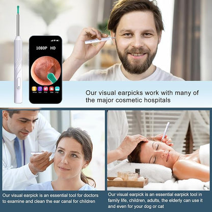 Ear Wax Removal Tool, Ear Cleaner with1080P HD Otoscope Camera, Ear Camera - Image 7