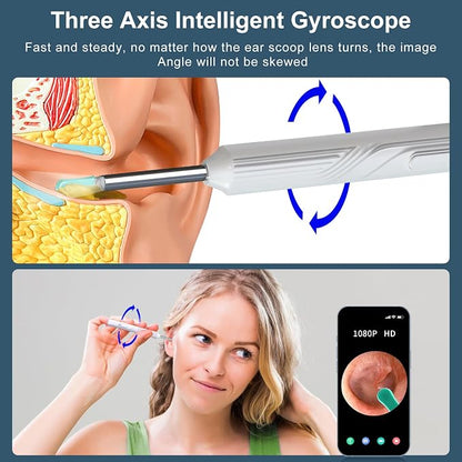 Ear Wax Removal Tool, Ear Cleaner with1080P HD Otoscope Camera, Ear Camera - Image 5